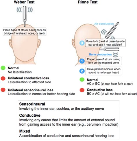 cerumen impaction rinne test|cerumen diagnosis.